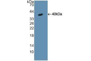 Western blot analysis of recombinant Rat KRT18. (Cytokeratin 18 Antikörper  (AA 72-380))