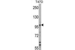 Western Blotting (WB) image for anti-Ubiquitin Protein Ligase E3A (ube3a) antibody (ABIN3001484) (ube3a Antikörper)