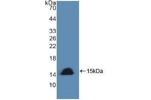 Western blot analysis of recombinant Human CASP8. (Caspase 8 Antikörper  (AA 385-479))