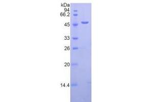 SDS-PAGE analysis of Human LAMP2 Protein. (LAMP2 Protein)