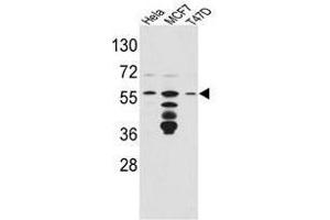 Image no. 1 for anti-FK506 Binding Protein 4, 59kDa (FKBP4) (Middle Region) antibody (ABIN453015) (FKBP4 Antikörper  (Middle Region))