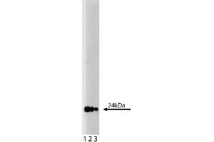 Western blot analysis of GRB2 on a PC-12 lysate (ABIN968539).