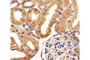 Immunohistochemistry (IHC) image for anti-Fms-Related Tyrosine Kinase 4 (FLT4) antibody (ABIN3030977)
