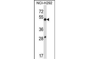 Western blot analysis in NCI-H292 cell line lysates (35ug/lane). (DUSP9 Antikörper  (C-Term))