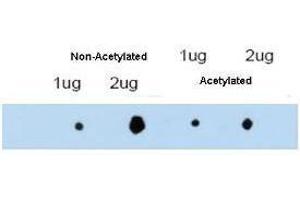 affinity purified anti-ATDC antibody shows reactivity by dot blot with acetylated and non-acetylated forms of the immunizing peptide. (TRIM29 Antikörper  (Internal Region))