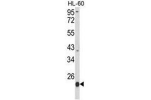 Western blot analysis of PSMB9 Antibody (C-term) in HL-60 cell line lysates (35ug/lane). (PSMB9 Antikörper  (C-Term))