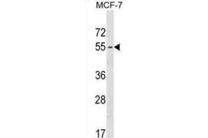 Western Blotting (WB) image for anti-Melanoma Antigen Family B, 18 (MAGEB18) antibody (ABIN3000090) (MAGEB18 Antikörper)