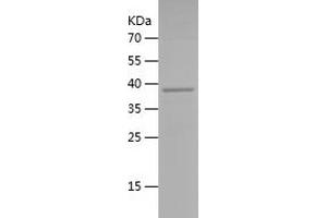 CYP2C8 Protein (AA 115-282) (His-IF2DI Tag)