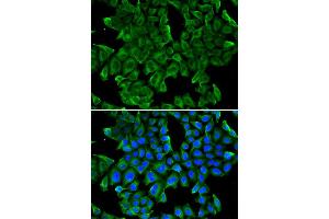 Immunofluorescence analysis of MCF-7 cell using REG3G antibody. (REG3g Antikörper)