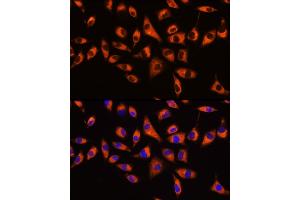 Immunofluorescence analysis of L929 cells using GNB2 Rabbit pAb  at dilution of 1:100 (40x lens). (GNB2 Antikörper  (AA 1-340))