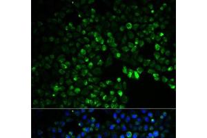 Immunofluorescence analysis of HeLa cells using UGDH Polyclonal Antibody (UGDH Antikörper)