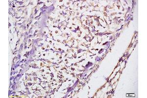 Immunohistochemistry (IHC) image for anti-Protein Kinase, CGMP-Dependent, Type I (PRKG1) antibody (ABIN720221)