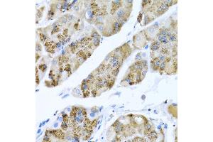 Immunohistochemistry of paraffin-embedded human stomach using MGP antibody at dilution of 1:100 (40x lens). (MGP Antikörper)