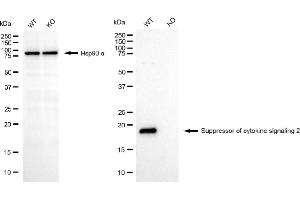 Western blotting analysis using suppressor of cytokine signaling 2 antibody (ABIN7800465). (Rekombinanter SOCS2 Antikörper)
