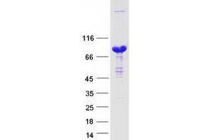 Thyroid Hormone Receptor Interactor 10 (TRIP10) protein (Myc-DYKDDDDK Tag)