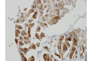 Immunoperoxidase of monoclonal antibody to DLD on formalin-fixed paraffin-embedded human heart. (DLD Antikörper  (AA 1-509))