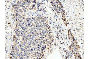 IHC analysis of BCKDK using anti-BCKDK antibody (ABIN7601470). (BCKDK Antikörper  (AA 36-316))