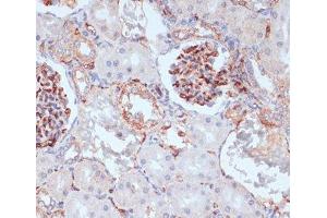 Immunohistochemistry of paraffin-embedded Rat kidney using CD34 Polyclonal Antibody at dilution of 1:100 (40x lens). (CD34 Antikörper)