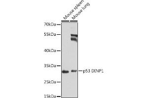Western blot analysis of extracts of various cell lines, using p53 DINP1 antibody (ABIN6133846, ABIN6149422, ABIN6149423 and ABIN6224287) at 1:1000 dilution. (TP53INP1 Antikörper  (AA 1-100))