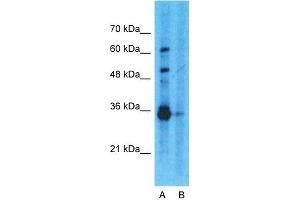 Host:  Rabbit  Target Name:  GAPDH  Sample Type:  293T  Lane A:  Primary Antibody  Lane B:  Primary Antibody + Blocking Peptide  Primary Antibody Concentration:  1ug/ml  Peptide Concentration:  5ug/ml  Lysate Quantity:  25ug/lane/lane  Gel Concentration:  0. (GAPDH Antikörper  (N-Term))