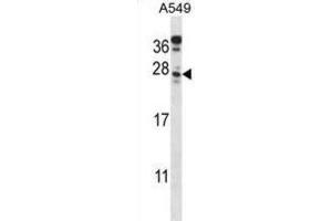 Western Blotting (WB) image for anti-Chromosome 4 Open Reading Frame 49 (C4orf49) antibody (ABIN2998187) (C4orf49 Antikörper)