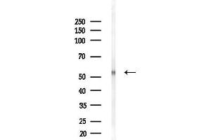 Western blot analysis of lysates from Rat liver, using SLC41 Antibody at 1/1000 dilution.
