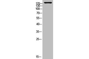 Western Blot analysis of customer's (cat sample) using Laminin γ-1 Polyclonal Antibody (Laminin gamma 1 Antikörper  (C-Term))
