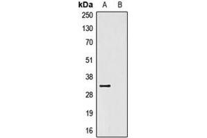 Western blot analysis of Anti-V5-tag Antibody against HEK293T cells transfected with vector overexpressing V5 tag (A) and untransfected (B). (V5 Epitope Tag Antikörper)