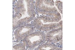 Immunohistochemical staining of human stomach with LRCH2 polyclonal antibody  shows cytoplasmic and membranous positivity in glandular cells. (LRCH2 Antikörper)