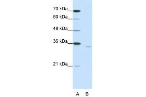 WB Suggested Anti-CPEB2 Antibody Titration:  1. (CPEB2 Antikörper  (Middle Region))