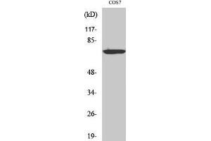 Western Blot (WB) analysis of specific cells using LIMK-1/2 Polyclonal Antibody. (LIMK-1/2 (Ser104) Antikörper)