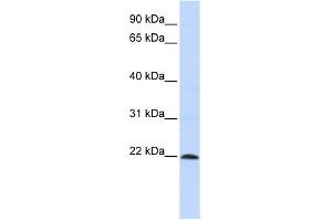WB Suggested Anti-ZNF581 Antibody Titration:  0. (ZNF581 Antikörper  (N-Term))