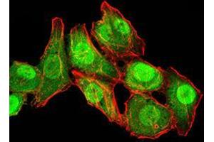 Immunocytochemistry (ICC) image for anti-RAN, Member RAS Oncogene Family (RAN) (AA 1-216) antibody (ABIN5876159) (RAN Antikörper  (AA 1-216))