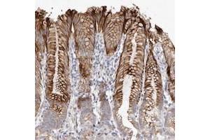 Immunohistochemical staining of human stomach with ZYG11A polyclonal antibody  shows strong cytoplasmic and membranous positivity in glandular cells at 1:50-1:200 dilution.