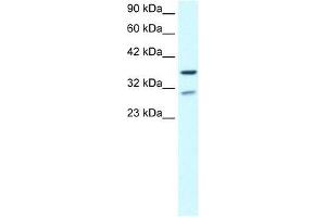 ZNF385 antibody used at 0.