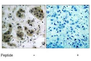 Image no. 1 for anti-V-Akt Murine Thymoma Viral Oncogene Homolog 1 (AKT1) (Ser473) antibody (ABIN197193) (AKT1 Antikörper  (Ser473))