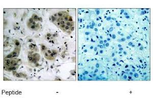 Image no. 1 for anti-V-Akt Murine Thymoma Viral Oncogene Homolog 1 (AKT1) (Ser473) antibody (ABIN197192) (AKT1 Antikörper  (Ser473))