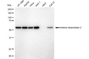 Western blotting analysis using Histone deacetylase 2 antibody (ABIN7798928).