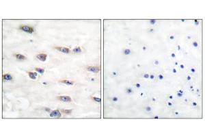Immunohistochemical analysis of paraffin-embedded human brain tissue using Trk A (phospho-Tyr791) antibody. (TRKA Antikörper  (pTyr791))