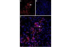 Expression of VPAC1 in rat amygdala - Immunohistochemical staining of immersion-fixed, free floating rat brain frozen sections using Anti-VPAC1 (VIPR1) (extracellular) Antibody (ABIN7043875, ABIN7045329 and ABIN7045330), (1:100). (VIPR1 Antikörper  (Extracellular))