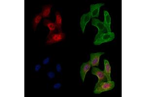 ABIN6257482 and ABIN6275890 staining Hela cells by IF/ICC. (RRM2B Antikörper  (N-Term))