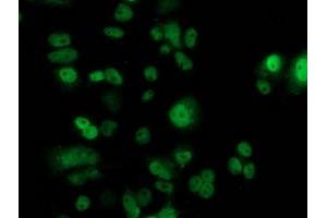 Anti-TP53 mouse monoclonal antibody (ABIN2454483) immunofluorescent staining of COS7 cells transiently transfected by pCMV6-ENTRY TP53 (RC200003). (p53 Antikörper)