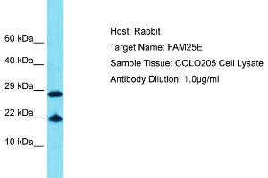 Host: Rabbit Target Name: FAM25E Sample Tissue: Human COLO205 Whole Cell Antibody Dilution: 1ug/ml (FAM25E Antikörper  (C-Term))