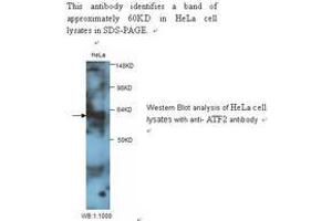 Image no. 1 for anti-Glial Cell Line Derived Neurotrophic Factor (GDNF) antibody (ABIN790851)