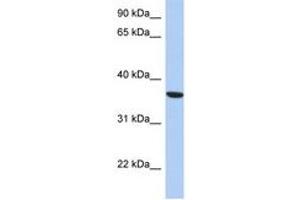 Image no. 1 for anti-Phosphoseryl-tRNA Kinase (PSTK) (AA 143-192) antibody (ABIN6743250) (PSTK Antikörper  (AA 143-192))