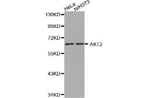 Western blot analysis of extracts of various cell lines, using AKT2 antibody. (AKT2 Antikörper)