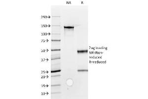 SDS-PAGE Analysis Purified ROR2 Mouse Monoclonal Antibody (ROR2/1912). (ROR2 Antikörper)