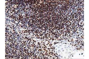 Image no. 1 for anti-Myocyte Enhancer Factor 2C (MEF2C) antibody (ABIN1499366) (MEF2C Antikörper)