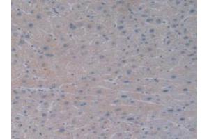 DAB staining on IHC-P; Samples: Human Liver Tissue. (BMP10 Antikörper  (AA 315-424))
