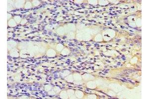Immunohistochemistry (IHC) image for anti-Thioredoxin 2 (TXN2) (AA 1-166) antibody (ABIN7172045)